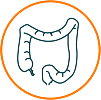 Colon cancer