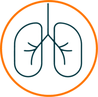 Lung cancer